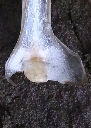 胞子嚢(大胞子)